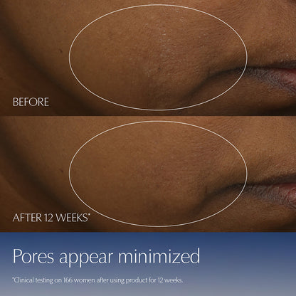 Estée Lauder Advanced Night Repair Serum Synchronized Multi-Recovery Complex